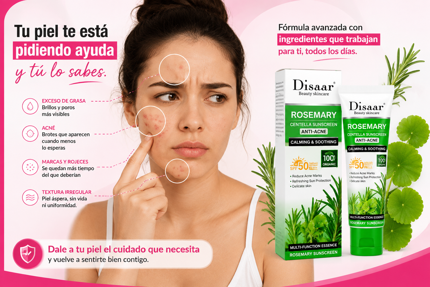 Piel con acné, exceso de grasa, marcas y rojeces, textura irregular — Disaar Crema Anti-Acné Rosemary Centella SPF 50
