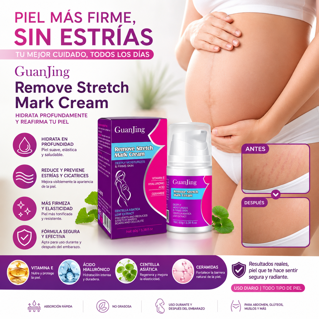 Piel más firme, sin estrías – GuanJing Crema Anti Estrías, resultados