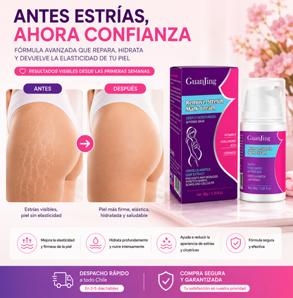 Antes estrías, ahora confianza – GuanJing Crema Anti Estrías