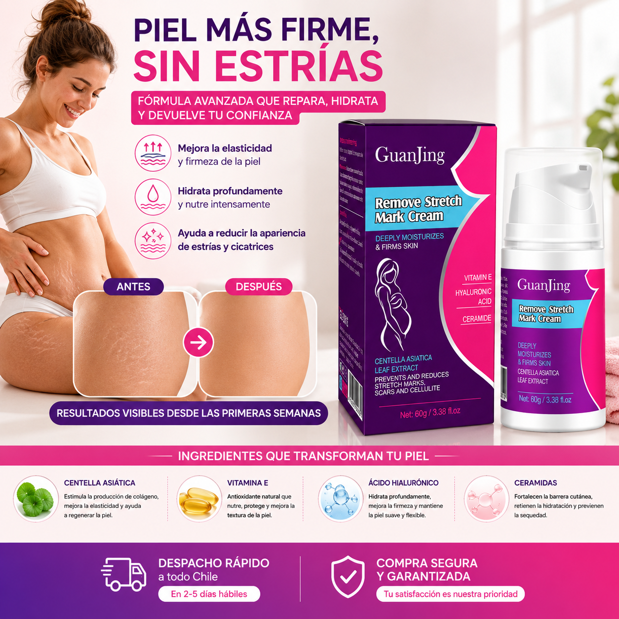 Piel más firme, sin estrías – GuanJing Crema Anti Estrías, beneficios