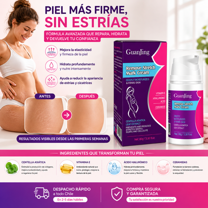 Piel más firme, sin estrías – GuanJing Crema Anti Estrías, beneficios