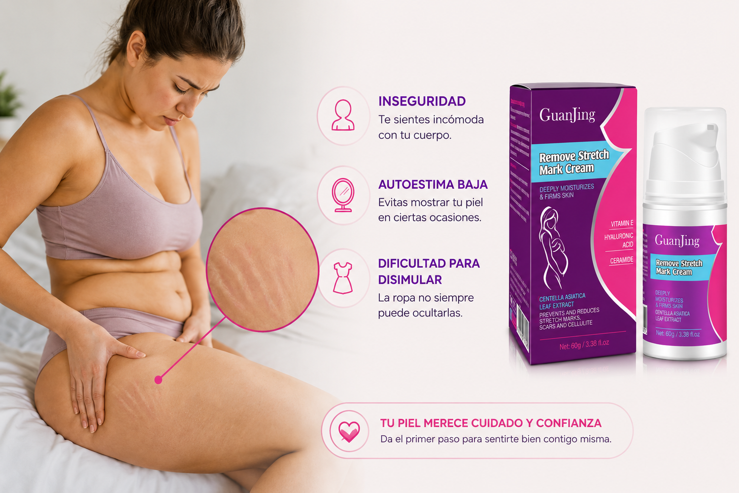 Inseguridad, autoestima baja y dificultad para disimular estrías — GuanJing Crema Anti Estrías Reparadora Hidratante