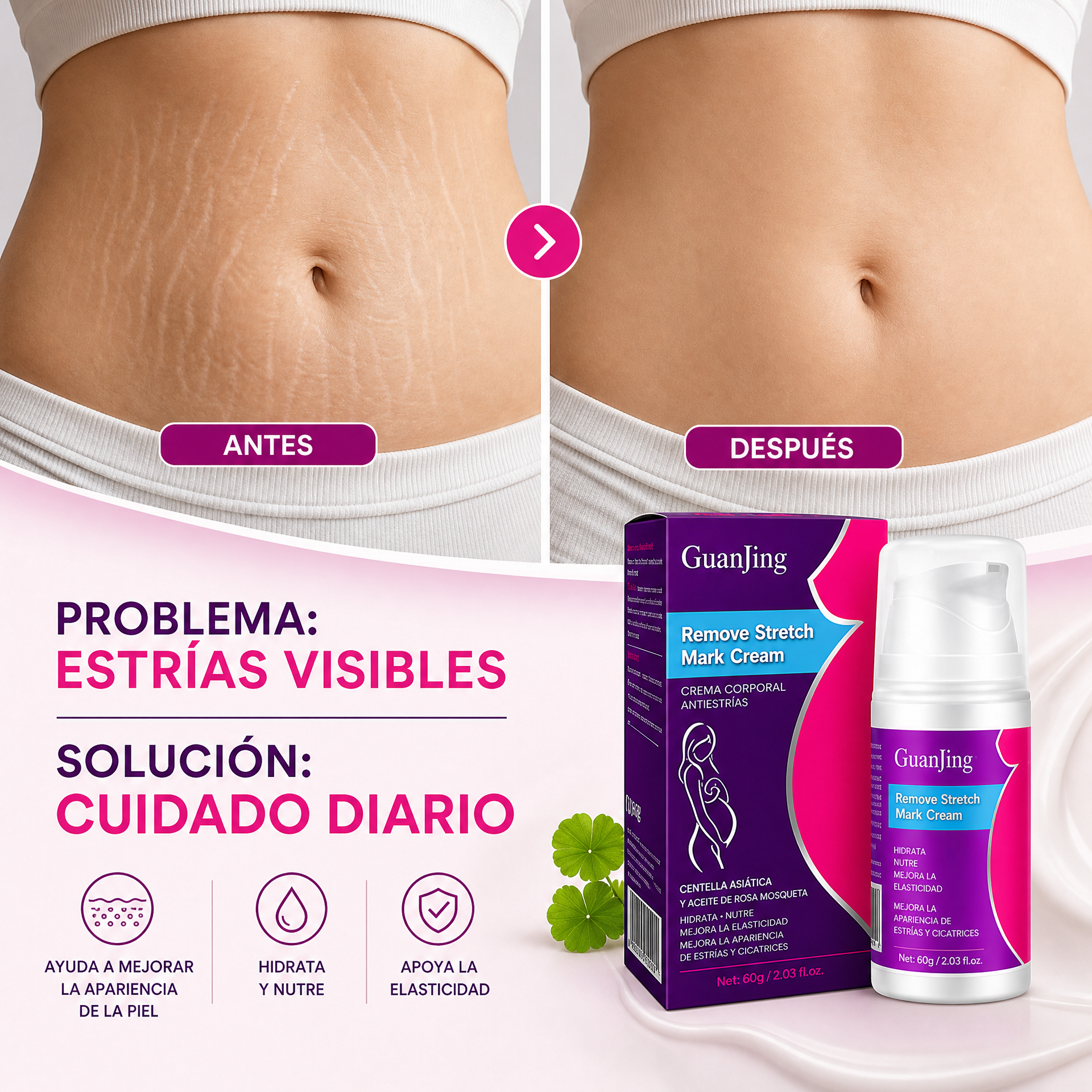 Antes y después – GuanJing Crema Anti Estrías Reparadora Hidratante