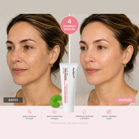 Antes y después: 4 semanas usando Crema Koriderm Time Reverse